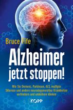 Cover-Bild Alzheimer jetzt stoppen!