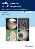 Cover-Bild Arthroskopie am Kniegelenk