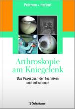 Cover-Bild Arthroskopie am Kniegelenk