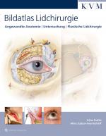 Cover-Bild Bildatlas Lidchirurgie