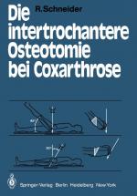 Cover-Bild Die intertrochantere Osteotomie bei Coxarthrose