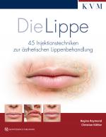 Cover-Bild Die Lippe