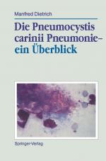 Cover-Bild Die Pneumocystis carinii Pneumonie— ein Überblick