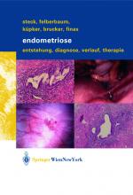 Cover-Bild Endometriose
