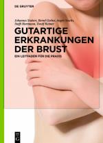 Cover-Bild Gutartige Erkrankungen der Brust