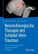 Cover-Bild Neurochirurgische Therapie des Schädel-Hirn-Traumas
