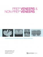 Cover-Bild Prep Veneers und Non-Prep Veneers