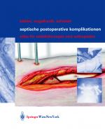 Cover-Bild Septische postoperative Komplikationen