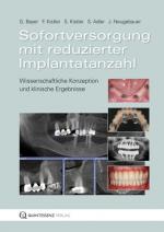 Cover-Bild Sofortversorgung mit reduzierter Implantatanzahl