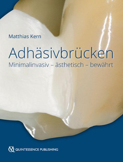 Cover-Bild Adhäsivbrücken