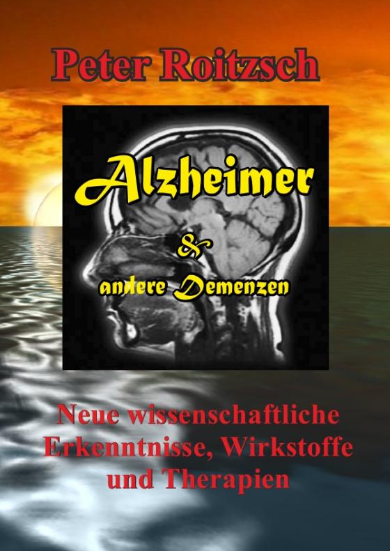 Cover-Bild Alzheimer & andere Demenzen