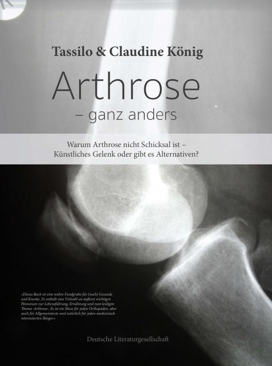 Cover-Bild Arthrose – ganz anders