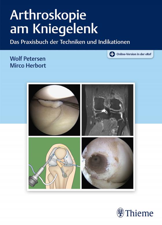 Cover-Bild Arthroskopie am Kniegelenk