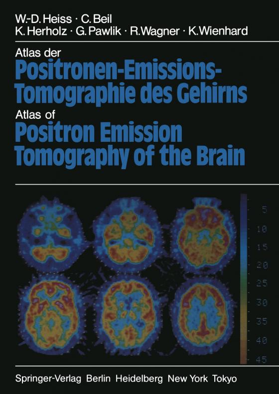 Cover-Bild Atlas der Positronen-Emissions-Tomographie des Gehirns / Atlas of Positron Emission Tomography of the Brain