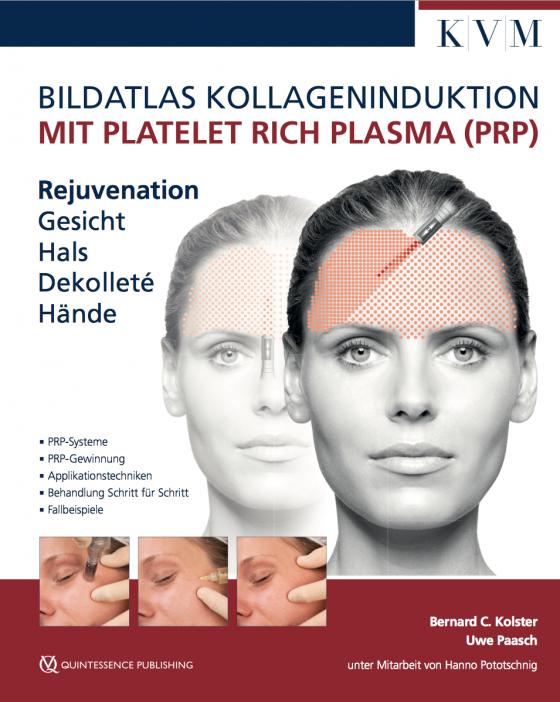 Cover-Bild Bildatlas Kollageninduktion mit Platelet Rich Plasma (PRP)