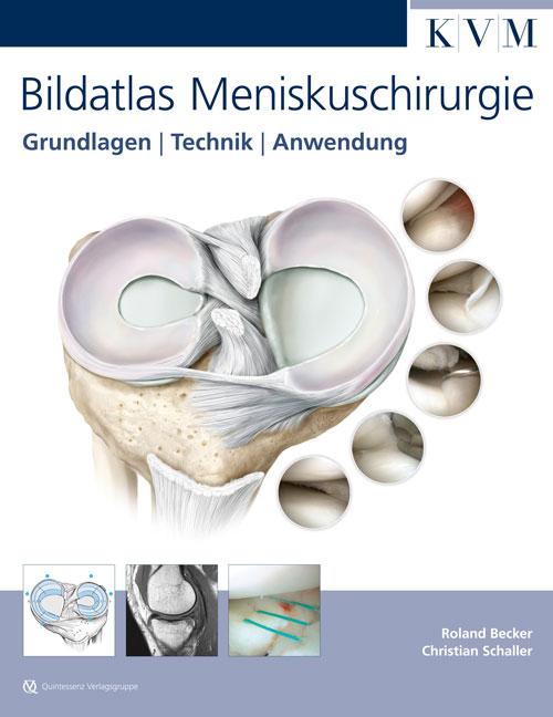 Cover-Bild Bildatlas Meniskuschirurgie