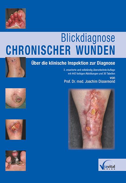 Cover-Bild Blickdiagnose chronischer Wunden