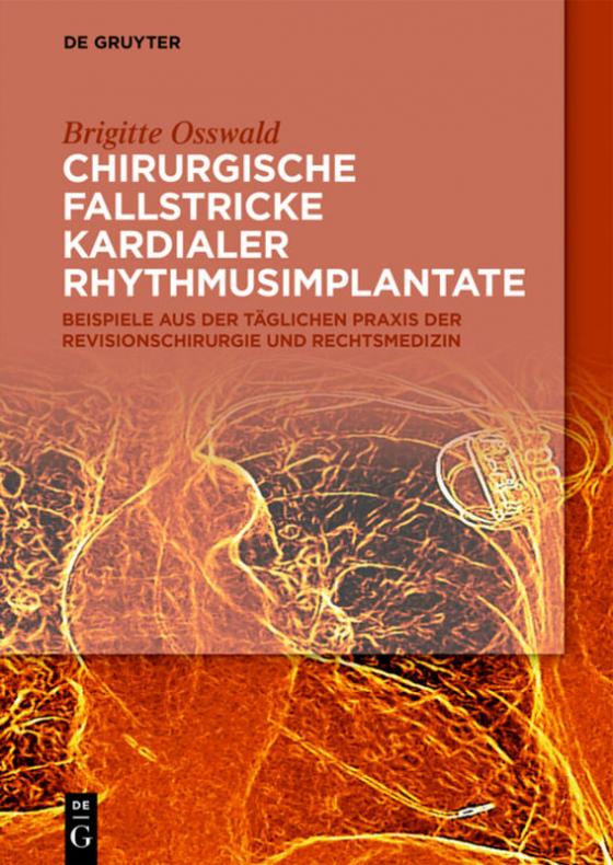 Cover-Bild Chirurgische Fallstricke kardialer Rhythmusimplantate