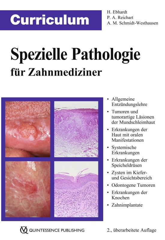 Cover-Bild Curriculum Spezielle Pathologie für Zahnmediziner