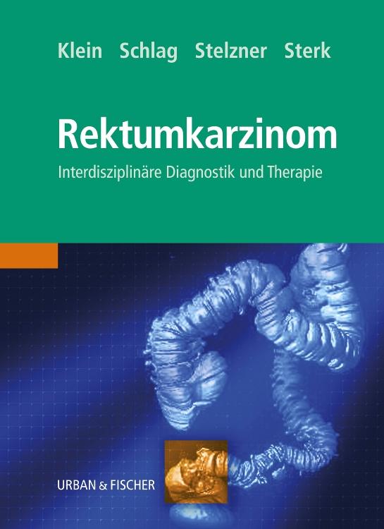 Cover-Bild Das Rektumkarzinom