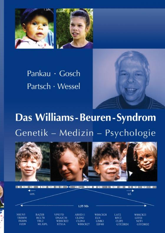 Cover-Bild Das Williams-Beuren-Syndrom