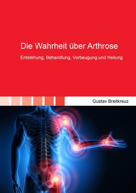 Cover-Bild Die Wahrheit über Arthrose