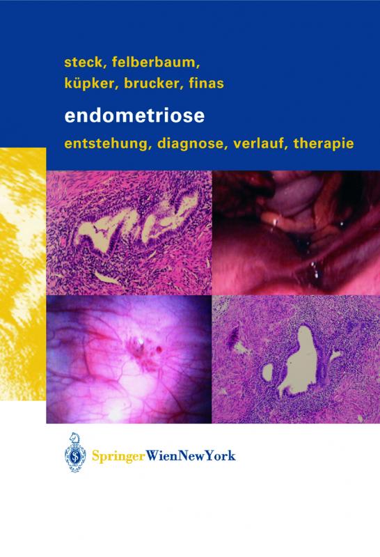 Cover-Bild Endometriose