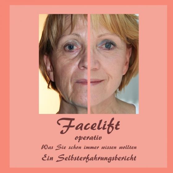 Cover-Bild Facelift operativ