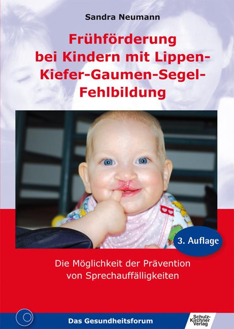 Cover-Bild Frühförderung bei Kindern mit Lippen-Kiefer-Gaumen-Segel-Fehlbildung