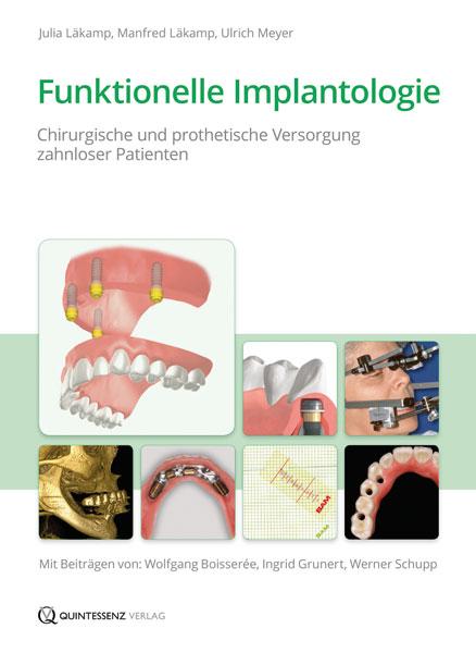 Cover-Bild Funktionelle Implantologie