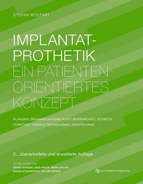 Cover-Bild Implantatprothetik