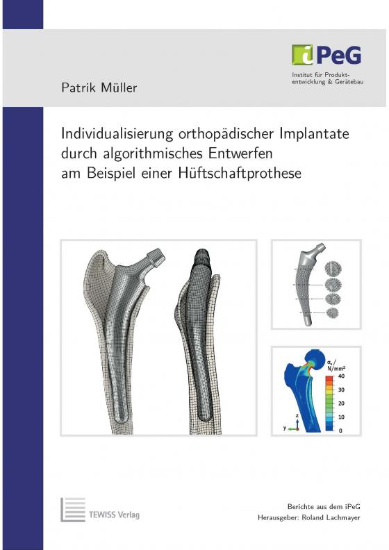 Cover-Bild Individualisierung orthopädischer Implantate durch algorithmisches Entwerfen am Beispiel einer Hüftschaftprothese