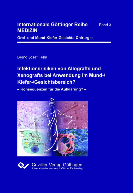 Cover-Bild Infektionsrisiken von Allografts und Xenografts bei Anwendung im Mund-/Kiefer-/Gesichtsbereich?