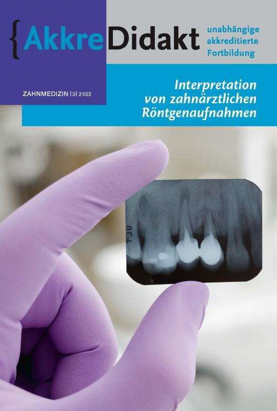 Cover-Bild Interpretation zahnmedizinischer Röntgenaufnahmen