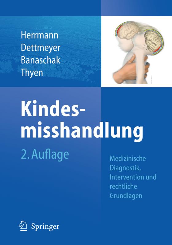 Cover-Bild Kindesmisshandlung