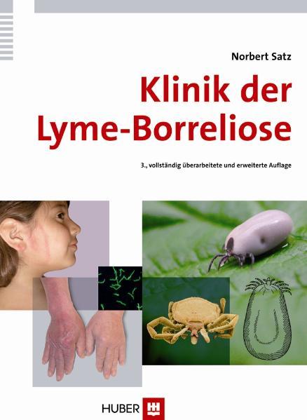 Cover-Bild Klinik der Lyme-Borreliose
