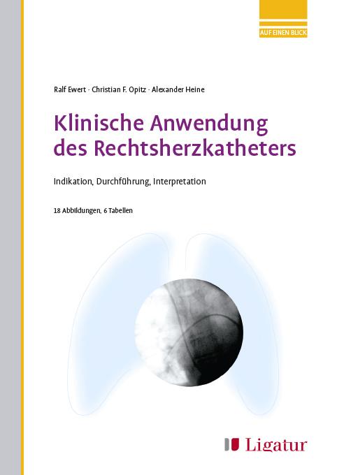 Cover-Bild Klinische Anwendung des Rechtsherzkatheters