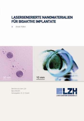 Cover-Bild Lasergenerierte Nanomaterialien für bioaktive Implantate