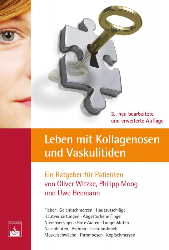 Cover-Bild Leben mit Kollagenosen und Vaskulitiden