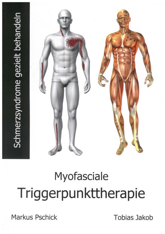 Cover-Bild Myofasciale Triggerpunkttherapie