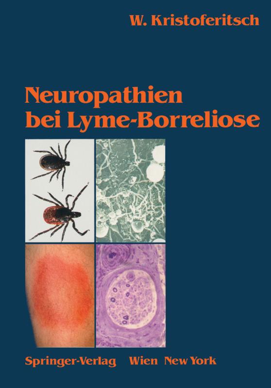 Cover-Bild Neuropathien bei Lyme-Borreliose