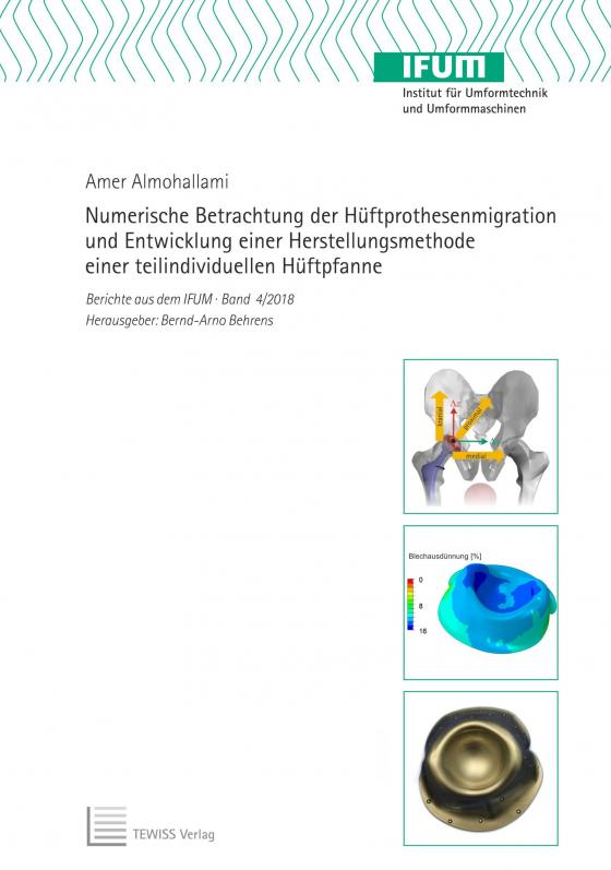 Cover-Bild Numerische Betrachtung der Hüftprothesenmigration und Entwicklung einer Herstellungsmethode einer teilindividuellen Hüftpfanne