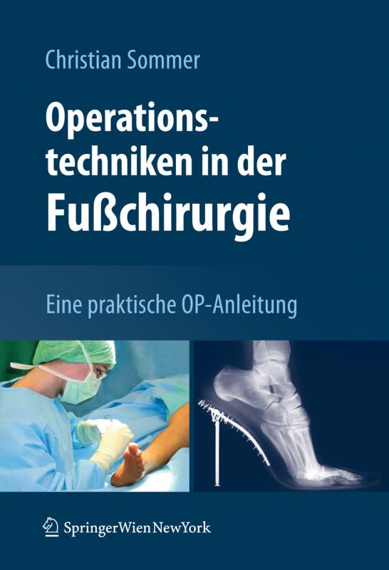 Cover-Bild Operationstechniken in der Fußchirurgie