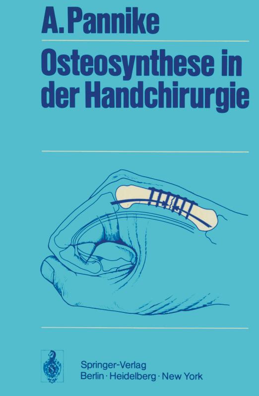 Cover-Bild Osteosynthese in der Handchirurgie
