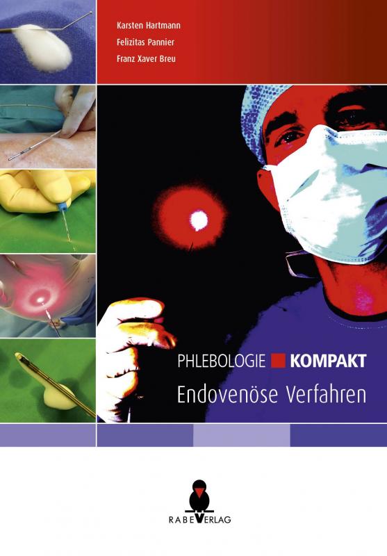 Cover-Bild Phlebologie kompakt - Endovenöse Verfahren