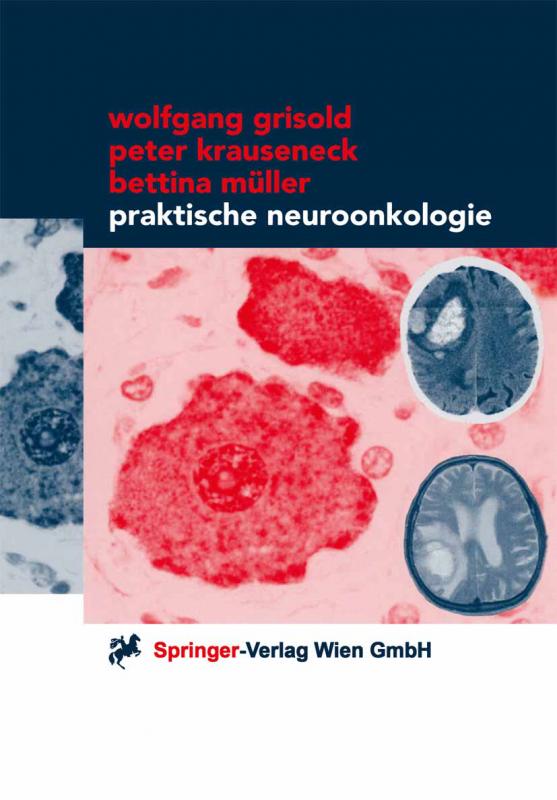 Cover-Bild Praktische Neuroonkologie