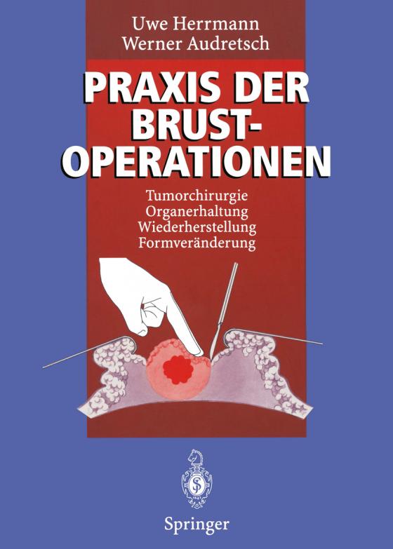 Cover-Bild Praxis der Brustoperationen