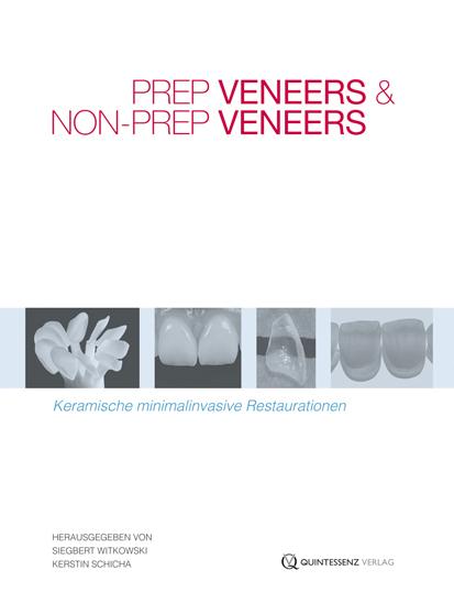 Cover-Bild Prep Veneers und Non-Prep Veneers