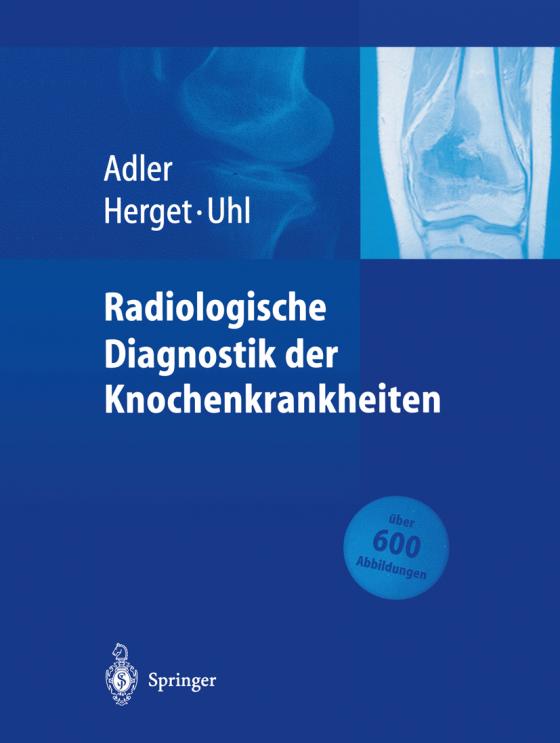 Cover-Bild Radiologische Diagnostik der Knochenkrankheiten