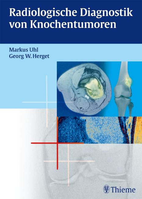 Cover-Bild Radiologische Diagnostik von Knochentumoren